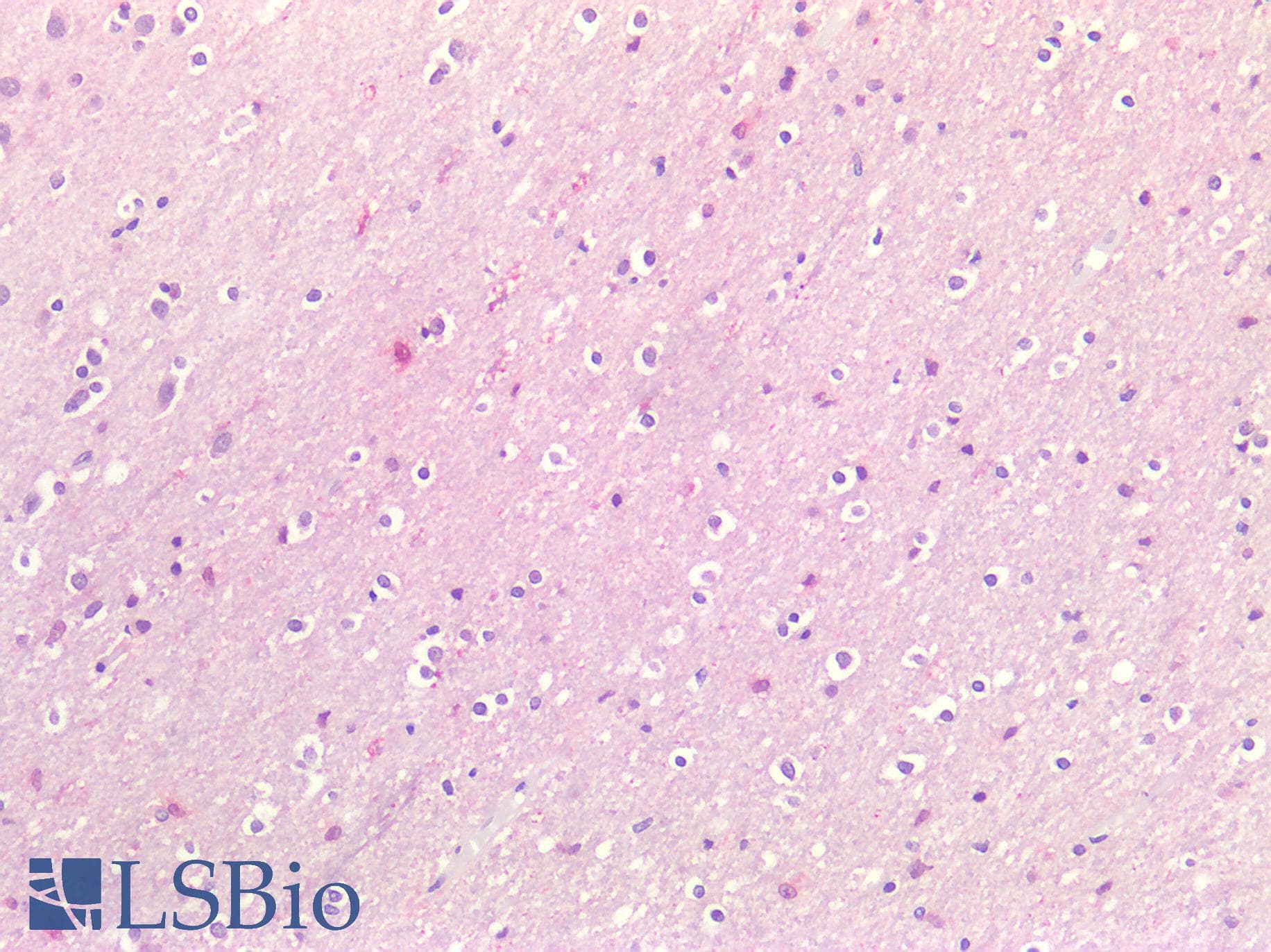 PathPlus™ ACVRL1 Antibody (aa196-245)