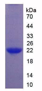 Human IL37 Protein (Recombinant His-T7)