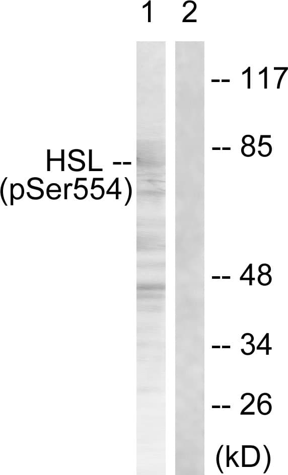 Polyclonal Rabbit anti-Human LIPE / HSL Antibody (phospho-Ser855/Ser554, IHC, WB)