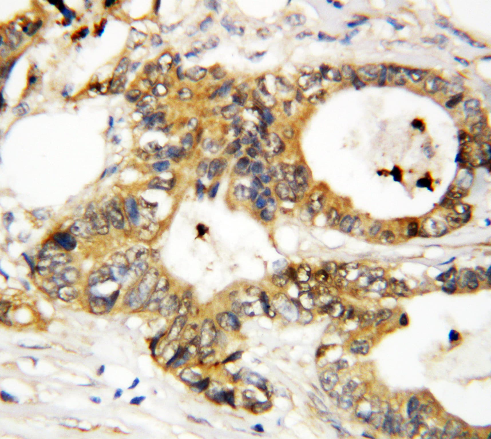 ANXA3 / Annexin A3 Antibody (aa124-141)