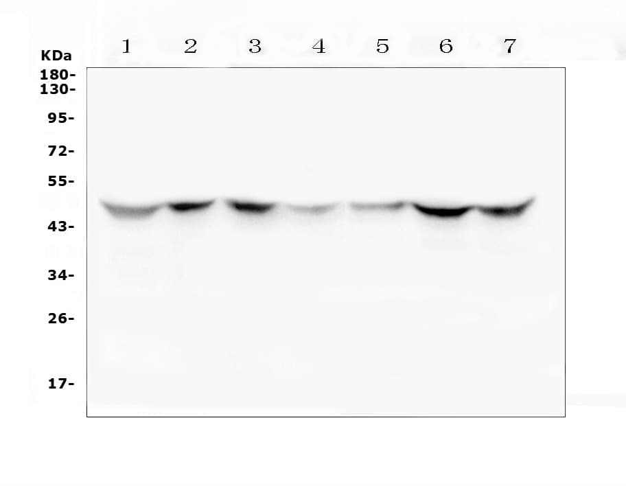 Polyclonal Rabbit anti-Human TGFB2 / TGF Beta2 Antibody (WB)