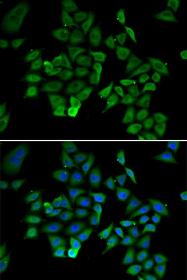Polyclonal Rabbit anti-Human NFKBIB / IKB Beta / IKBB Antibody (IHC, IF, WB)