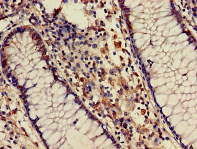 AICAR / ATIC Antibody