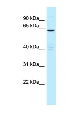 Polyclonal Rabbit anti-Human MTMR6 Antibody (aa531-580, WB)