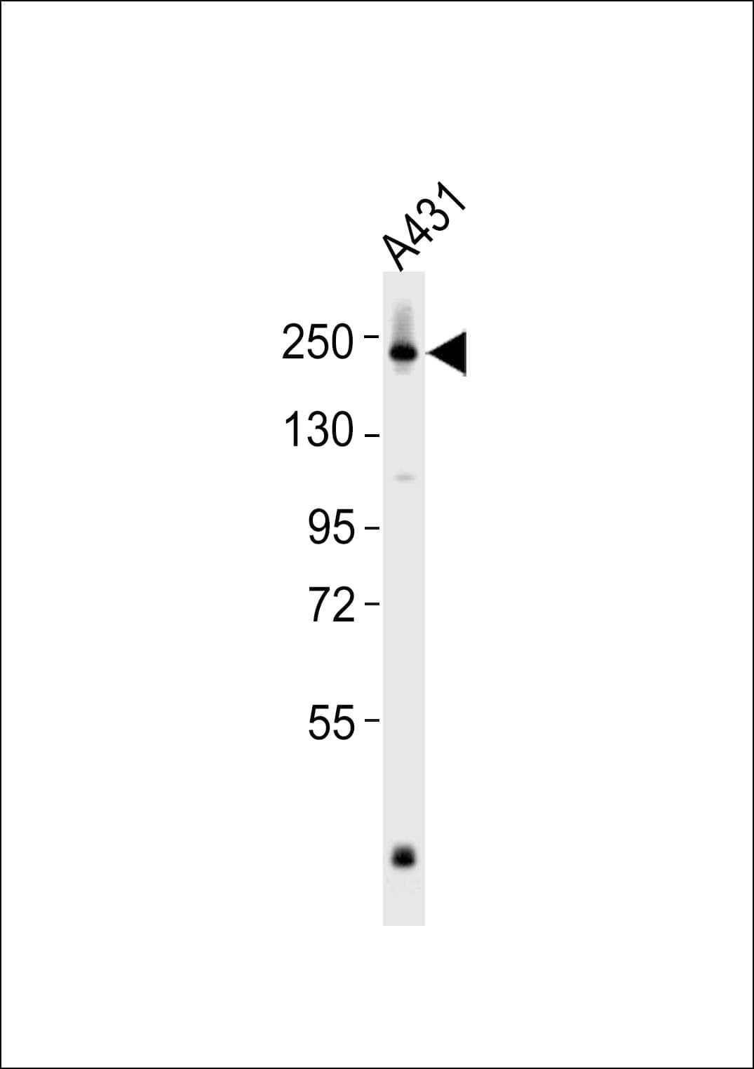 POLA1 / DNA Polymerase Alpha 1 Antibody