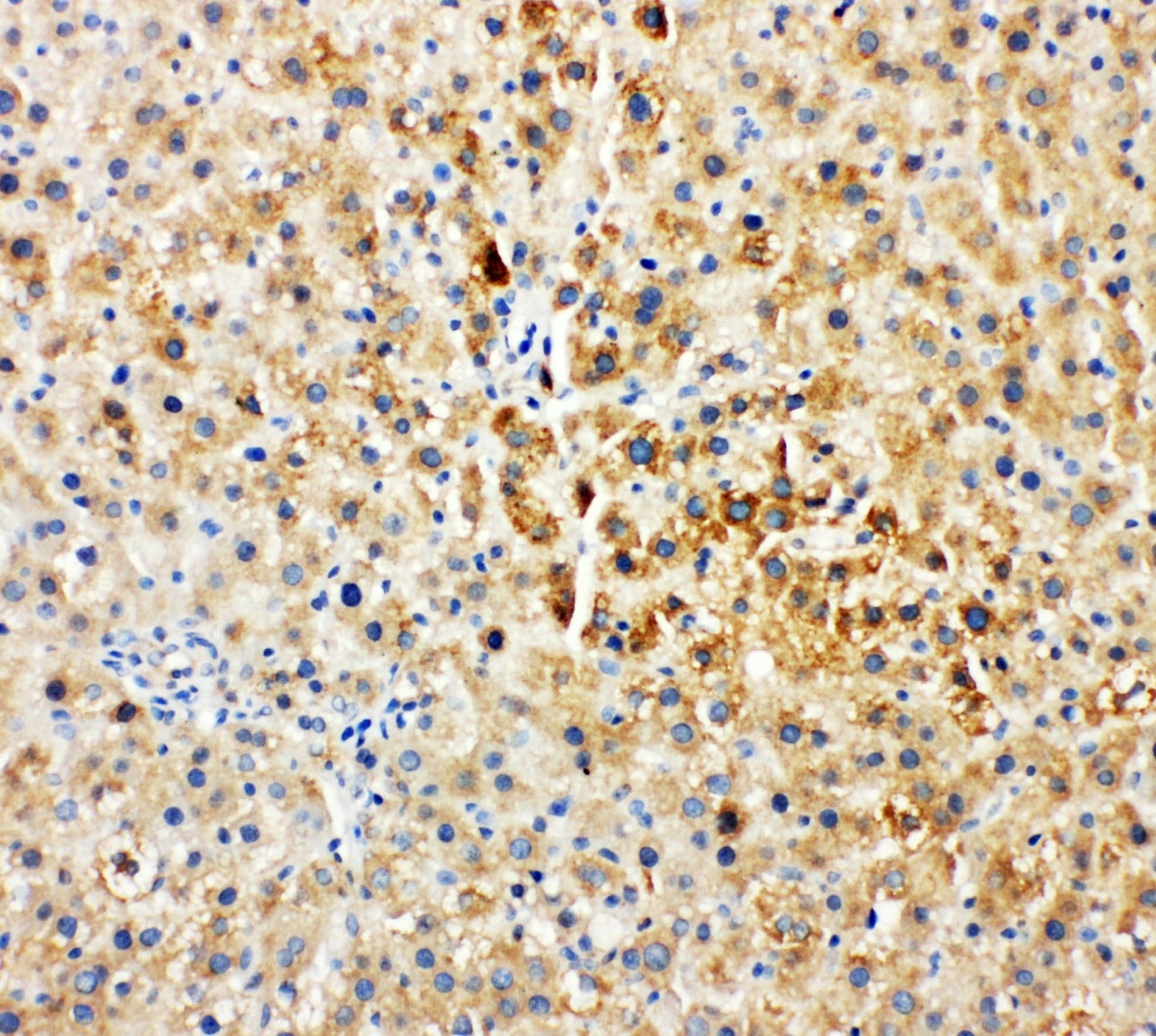 TEC Antibody (aa612-631)