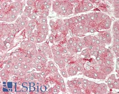 IHC-plus™ Polyclonal Rabbit anti-Human CLC-7 / CLCN7 Antibody (aa23-72, IHC, WB)