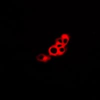 GPR48 / LGR4 Antibody