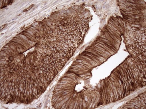 Monoclonal Mouse anti-Human EPLIN Antibody (clone OTI9F3, aa1-275, IHC, WB)