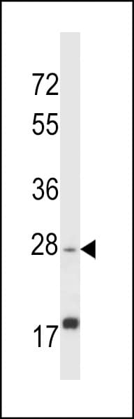 Polyclonal Rabbit anti-Human APOOL / Apolipoprotein O-Like Antibody (aa172-200, IHC, WB)