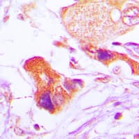 BCL2 / Bcl-2 Antibody (phospho-Ser70)