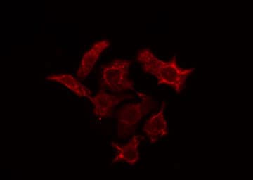 Polyclonal Rabbit anti-Human PDE4C Antibody (IF, WB)