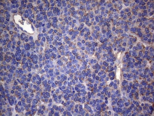 IRF3 Antibody (aa27-169, clone OTI4A1)