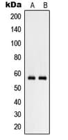 Polyclonal Rabbit anti-Human RHCG Antibody (Internal, WB)