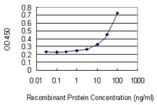 IHC-plus™ PIGR Antibody (clone 2G5)