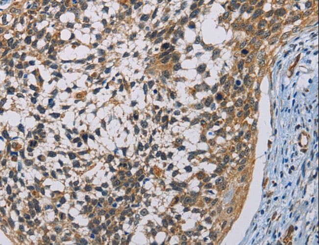 Polyclonal Rabbit anti-Human CSNK1E / CK1 Epsilon Antibody (IHC, WB)