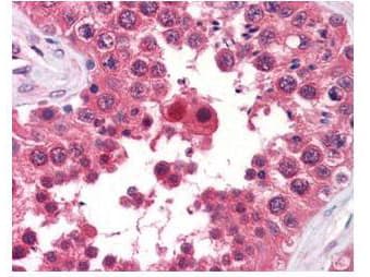 IHC-plus™ Monoclonal Rat anti-Human AHSA1 / AHA1 Antibody (clone 25F2.D9, IHC, WB)