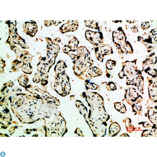 Polyclonal Rabbit anti-Human TGFB2 / TGF Beta2 Antibody (IHC, WB)