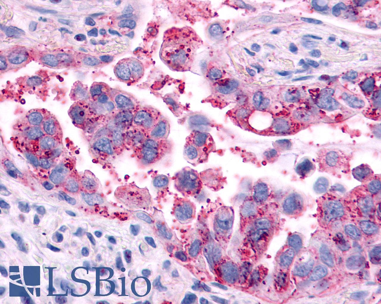 Polyclonal Rabbit anti-Human AVPR2 / V2R Antibody (Cytoplasmic Domain, IHC)