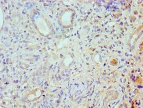 ROCK2 Antibody (aa1109-1388)