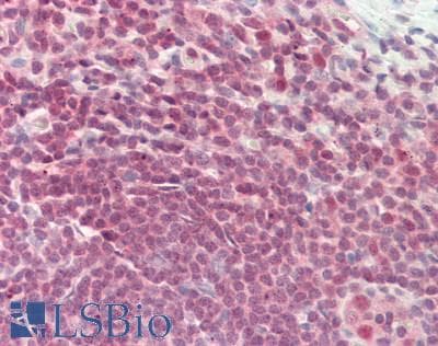 IHC-plus™ CUL5 / Cullin-5 Antibody (aa1-50)