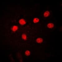 HMG1 / HMGB1 Antibody (Internal)