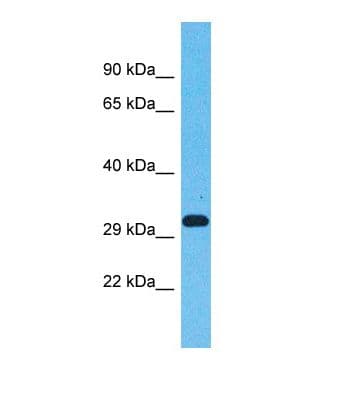 Polyclonal Rabbit anti-Human OR5AN1 Antibody (C-Terminus, WB)