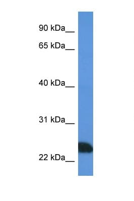 PRSS1 / Trypsin Antibody (N-Terminus)