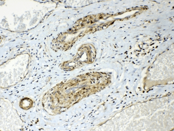 Polyclonal Rabbit anti-Human HSPB8 / H11 / HSP22 Antibody (IHC, WB)