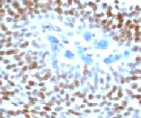 TP53 / p53 Antibody (clone CTA53-1)
