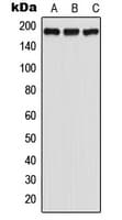 Polyclonal Rabbit anti-Human ADGRA3 / GPR125 Antibody (Internal, WB)