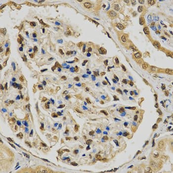 EGLN1 / PHD2 Antibody
