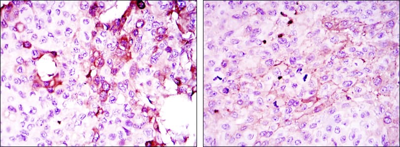 OPG / Osteoprotegerin Antibody (clone 5A11)