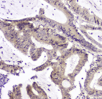 PPCS Antibody