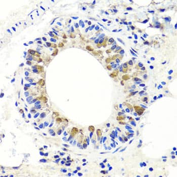 Endonuclease G / ENDOG Antibody