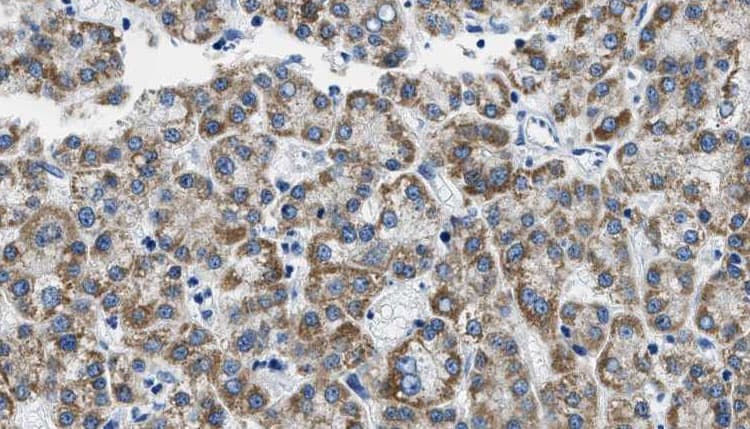 CD4 Antibody