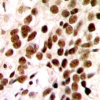 TFB1 / GTF2H1 Antibody (N-Terminus)