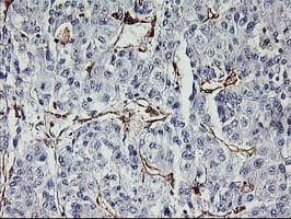 Monoclonal Mouse anti-Human VASP Antibody (clone OTI1F3, IHC, WB)