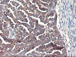 RPN1 / Ribophorin I Antibody (clone OTI2E3)