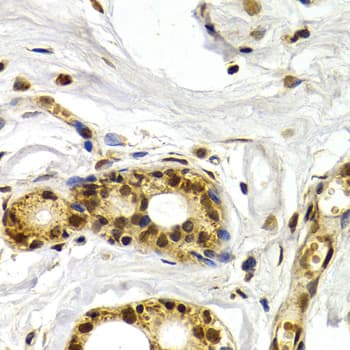 ATF2 Antibody
