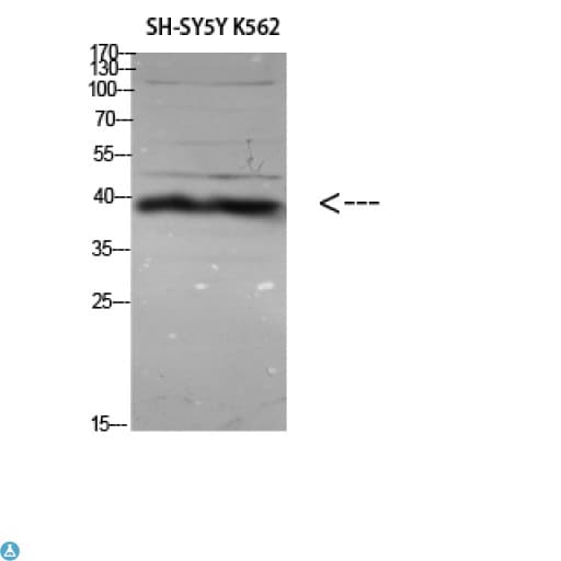 ERLIN1 / SPFH1 Antibody