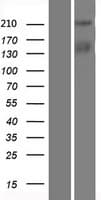 TICRR Protein (Over-Expression Lysate Myc-DDK (Flag))