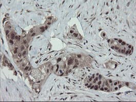 ESRRG / ERR Gamma Antibody (aa24-263, clone OTI1E5)