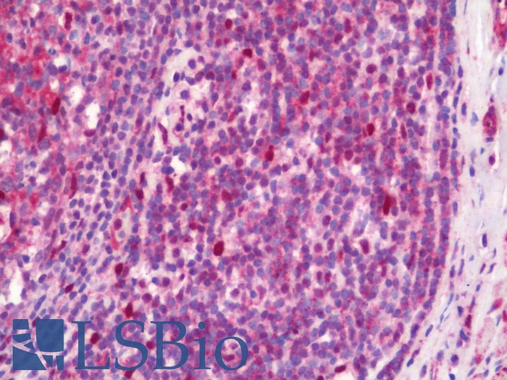 IHC-plus™ STAT1 Antibody (aa141-190)