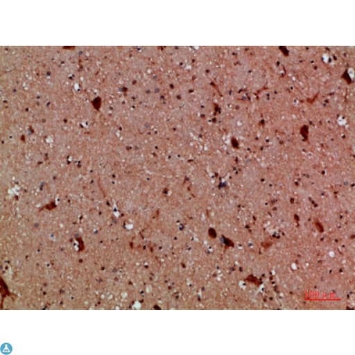 CALB2 / Calretinin Antibody