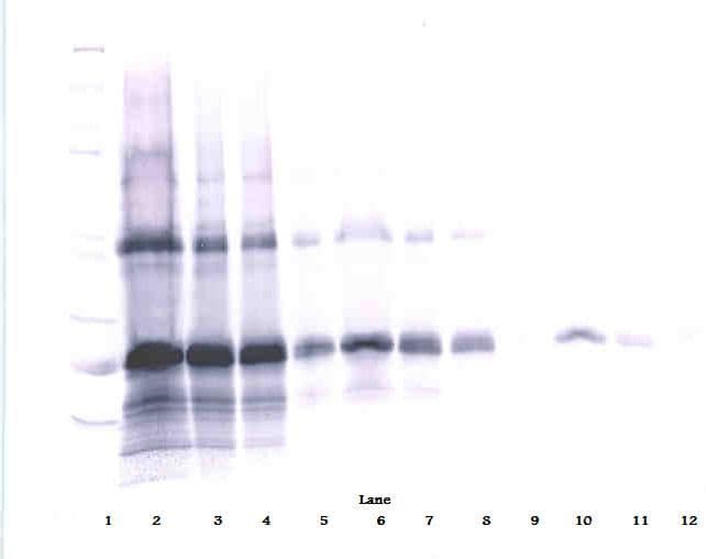 IL6 / Interleukin 6 Antibody