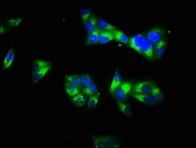 IHC-plus™ Polyclonal Rabbit anti-Human LAMC1 / Laminin Gamma 1 Antibody (IHC, WB)