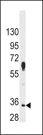 PIM2 / Pim-2 Antibody (aa277-308)
