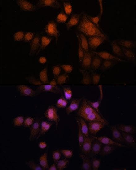 TWIST1 / TWIST Antibody