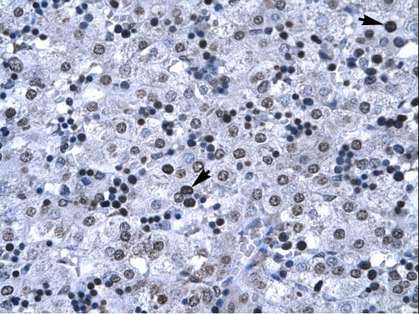 Polyclonal Rabbit anti-Human BF1 / FOXG1 Antibody (aa139-169, IHC, WB)